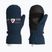 Children's ski gloves Rossignol Jr Roc Impr M dark navy