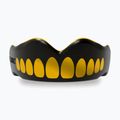 SAFEJAWZ Extro Series children's jaw protector black SJGOLDJ 3