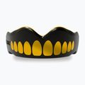 SAFEJAWZ Extro Series jaw protector black SJGOLDA 2