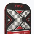 Pickleball paddle NOX Luxury Nerbo 5