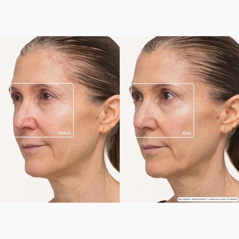 Face mask LED Therabody TheraFace LED Mask 10