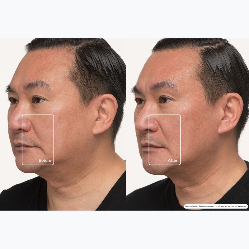 Face mask LED Therabody TheraFace LED Mask 12