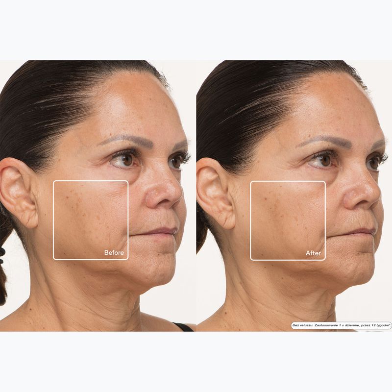 LED face mask Therabody TheraFace Mask Led 13